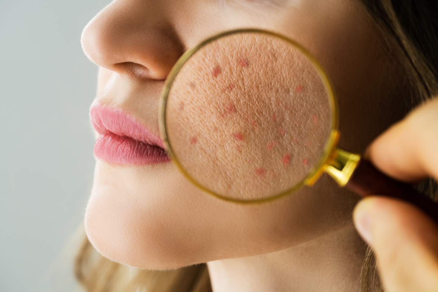 How can I prevent allergies? How can I prevent allergies?